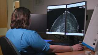 A radiologist reviews mammograms at Aberdeen Royal Infirmary