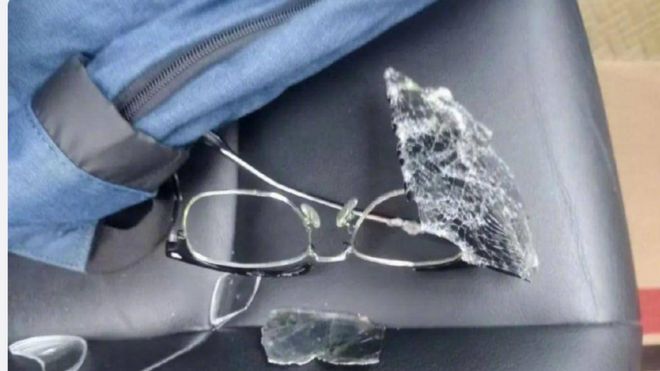 记者展示被打坏的眼镜
